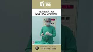 Multiple Lipoma Removal Treatment  Lipoma Removal Treatment in Delhi  Dr PK Talwar [upl. by Nurat]