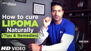 What Is Lipoma लाइपोमा  How to cure LIPOMA Naturally  Tips by Guru Mann [upl. by Stoller289]