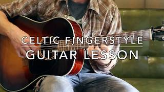 The Road To Lisdoonvarna Guitar Lesson Celtic Fingerstyle [upl. by Asi]