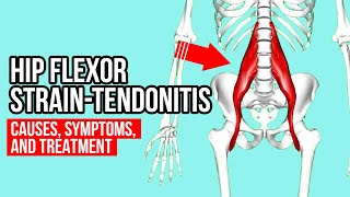 Why Common Patellar Tendonitis Rehab FAILS and 5 exercises that WORK [upl. by Strephon451]