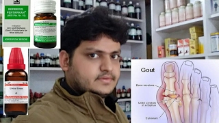 goutincreased uric acid and homeopathic medicine explain [upl. by Fablan]