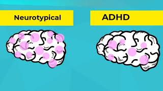 Infographics What is ADHD [upl. by Barna]