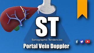 Portal Vein Doppler Protocol [upl. by Carrissa710]