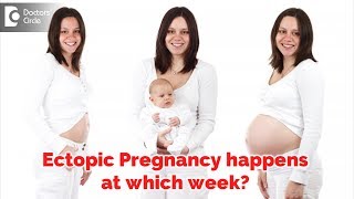 At which week does Ectopic Pregnancy usually happen  Dr Archana Kankal of Cloudnine Hospitals [upl. by Nnael]