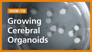 How to Grow Cerebral Organoids from Human Pluripotent Stem Cells [upl. by Noval105]