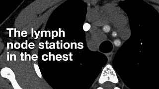 The Lymph Node Stations in the Chest [upl. by Kinemod756]