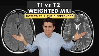 T1 vs T2 weighted MRI images How to tell the difference [upl. by Shore431]