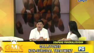 NonSurgical Treatment to Gallstones ENG SUB [upl. by Leoine]