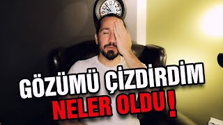 Göz Çizdirmeyi Düşünüyorsanız İzleyin İ  LASİK [upl. by New]