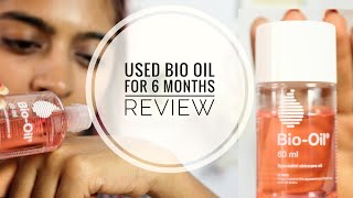 Bio Oil Review  Does Bio Oil Work on Stretch Marks amp Scars  SuperWowStyle [upl. by Enovaj]