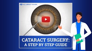 What to Expect During amp After Cataract Surgery [upl. by Gerard]