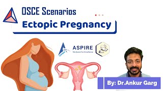 Ectopic pregnancy  OSCE Scenarios  Aspire Education  PLAB2 [upl. by Skiest331]