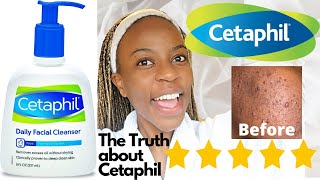 Cetaphil Skin Care Cleanser Review  Agnater [upl. by Bethesde577]