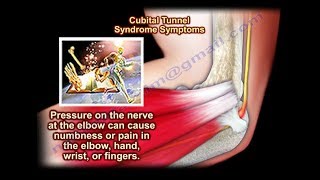 Cubital Tunnel Syndrome  Everything You Need To Know  Dr Nabil Ebraheim [upl. by Arch]