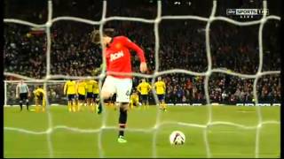 Manchester United Vs Sunderland Penalty Shootout 220114 [upl. by Eimam]