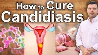 Natural Treatment 100 Effective Against Candidiasis  How to Cure Candida Naturally [upl. by Barny735]