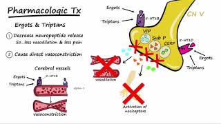 Migraines  Pathophysiology amp Treatment Described Concisely [upl. by Eitsirc373]