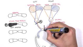 Visual Pathway and Lesions [upl. by Dilly]