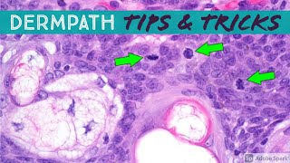 Dermatopathology Practical Tips amp Tricks for Pathology amp Dermatology [upl. by Crystie]