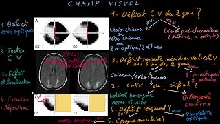 Champ visuel  Docteur Synapse [upl. by Wadleigh]