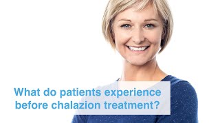 What do patients experience before and after chalazion treatment [upl. by Levitan]