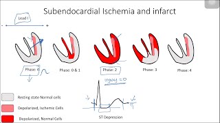 ST Elevation and Depression Electrophysiological Basis [upl. by Aholah]