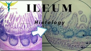 Histology of Ileum [upl. by Doralynne445]