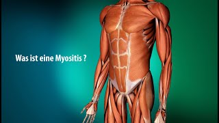 Erklärvideo Myositis [upl. by Ayote]