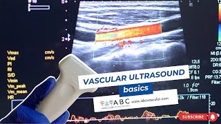 Vascular ultrasound basics [upl. by Ahseret]