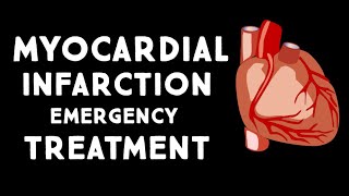 Myocardial Infarction MIHeart Attack Treatment in Emergency  Step wise STEMI Management USMLE [upl. by Lalittah]