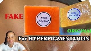 The Kojic Acid Soap That Works HOW TO IDENTIFY THE ORIGINAL [upl. by Bowra]