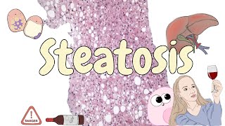 Steatosis  liver pathology [upl. by Phira190]