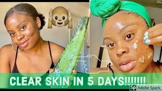 I USED FRESH ALOE VERA GEL ON MY SKIN FOR 5 DAYS amp THIS HAPPENED [upl. by Llirrem]