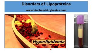 Hyperlipidemia Cholesterol Guidelines  Part 1 of 2 [upl. by Campman]