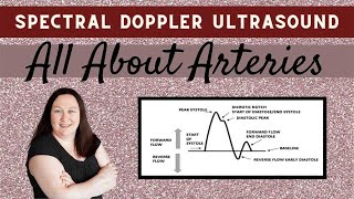 Spectral Doppler Ultrasound All About Arteries [upl. by Aicen]