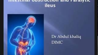 Intestinal Obstruction amp Paralytic Ileus  Surgery [upl. by Kahcztiy]