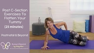 How To Flatten Your Tummy After A C Section  Postnatal Exercises [upl. by Eitsirhc719]