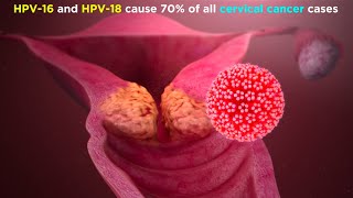 Human Papillomavirus HPV [upl. by Annayat952]