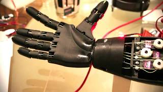 3D Printed Prosthetic Arm [upl. by Aneg110]