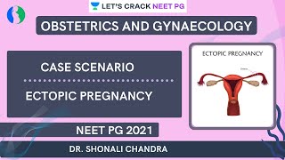 Case Scenario  Ectopic Pregnancy  NEET PG 2021  Dr Shonali Chandra [upl. by Sileas]