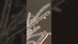 Coenocytic Hyphae [upl. by Ime]