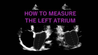 Measuring the LEFT ATRIUM VOLUME Echocardiography [upl. by Mcintosh]