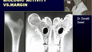 Radiographic Approach to Bone Lesions Part I [upl. by Poppas]