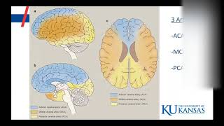 Left vs Right Brain Stroke Symptoms [upl. by Pate]