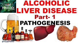 ALCOHOLIC LIVER DISEASE Part 1 Pathogenesis [upl. by Romanas316]