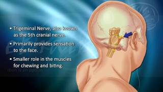 Trigeminal Neuralgia Surgery  Michelles Story [upl. by Teri425]