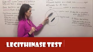 Lecithinase Test [upl. by Adriana]