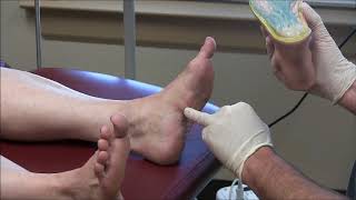 Plantar Fascitis Injection Technique [upl. by Zucker]