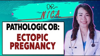 Lectures  Pathologic OB  Ectopic Pregnancy [upl. by Nyltyak]