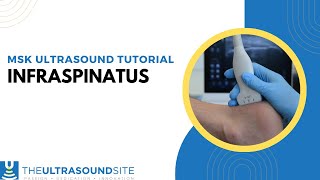 How to view the Infraspinatus tendon on ultrasound [upl. by Ynnor]